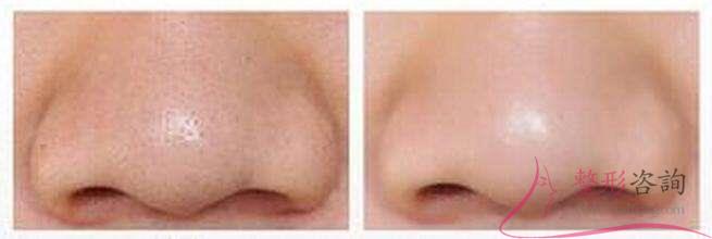 1625146630 1625146630