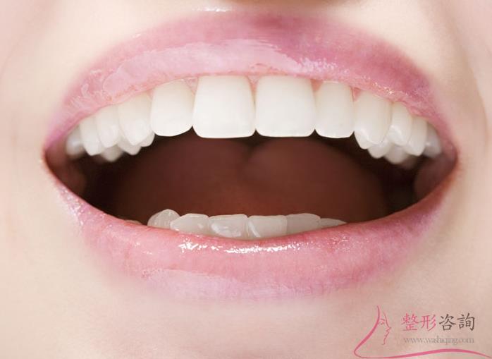 1649364167 1649364167