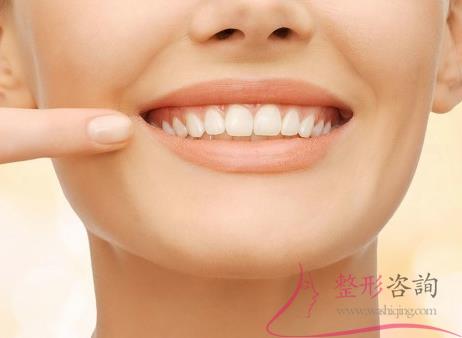 1706183864 1706183864