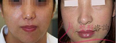 1614493566 1614493566