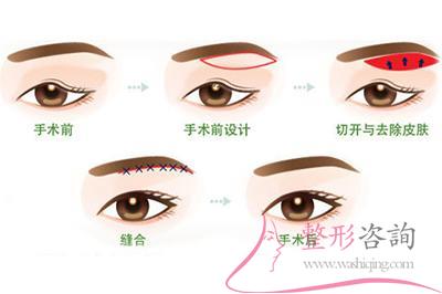 1051276034 1051276034