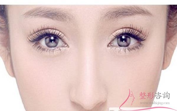 1440348101 1440348101