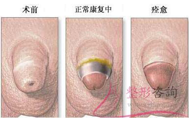 1444176197 1444176197