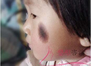 1744511222 1744511222