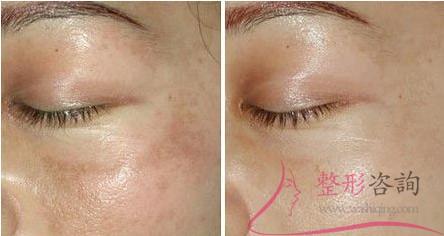 0928232839 0928232839