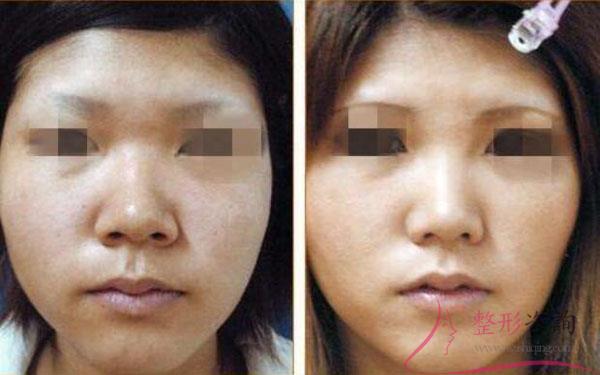 1602078190 1602078190