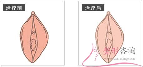 2035574846 2035574846