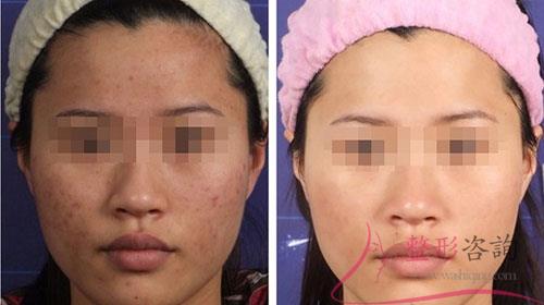 1526337480 1526337480