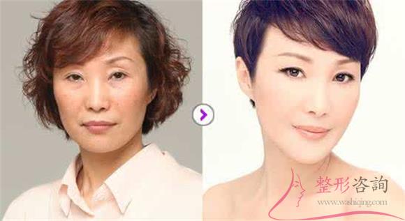 1658291787 1658291787