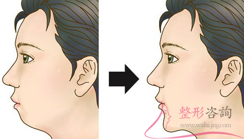 1521297888 1521297888