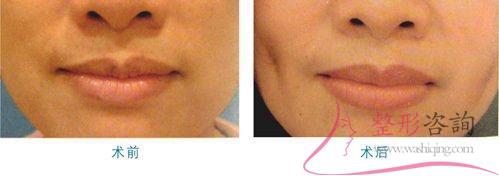 1601377479 1601377479