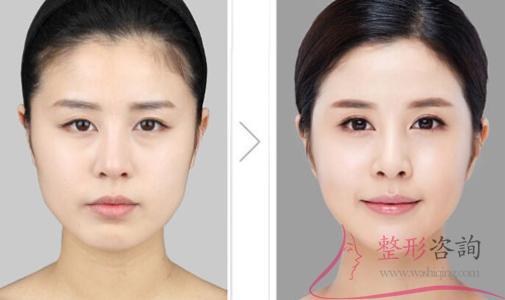 1658361107 1658361107