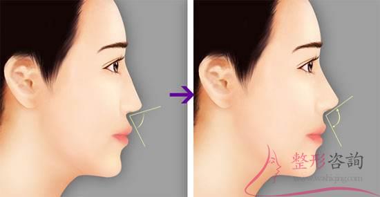 1724364235 1724364235