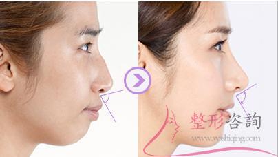 2131094952 2131094952