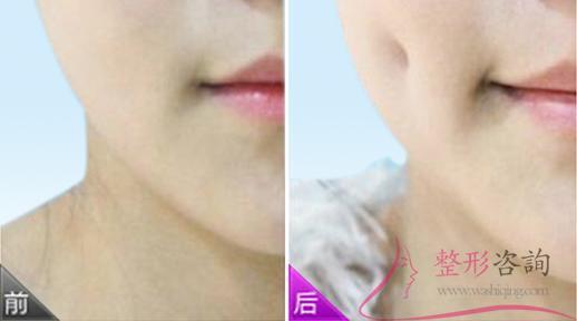 2306286389 2306286389