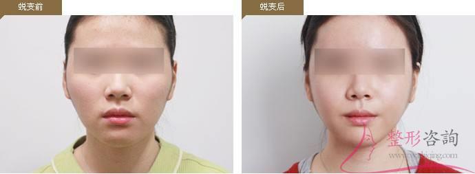 1137122758 1137122758