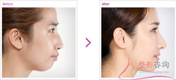 1412556462 1412556462