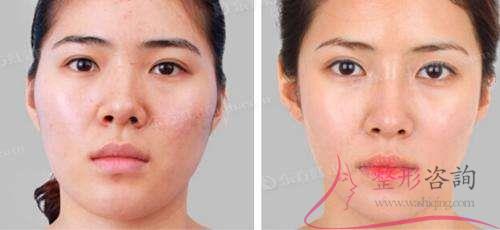 1502344456 1502344456