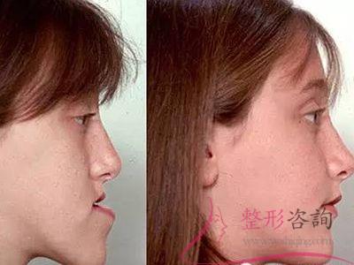 1700108609 1700108609