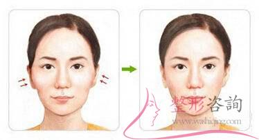 1706096937 1706096937