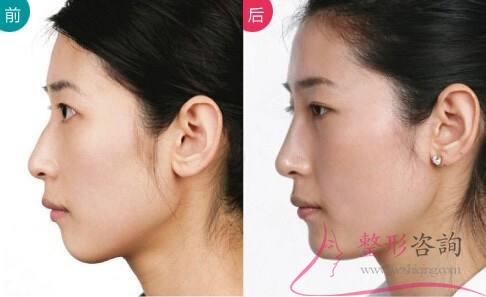 1707418245 1707418245