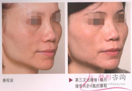 2057353999 2057353999