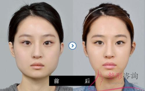 2154485744 2154485744