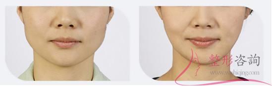 2317239878 2317239878