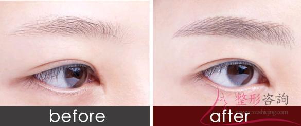 2150436333 2150436333