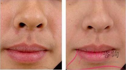 1213525078 1213525078