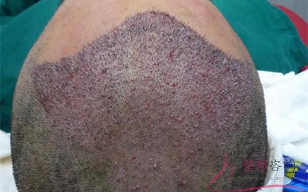 1454218255 1454218255