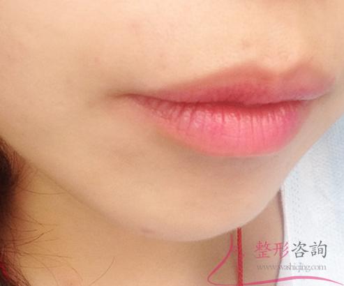 1500139484 1500139484