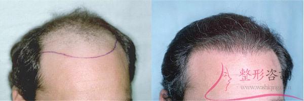 1526087106 1526087106