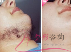 1851225556 1851225556