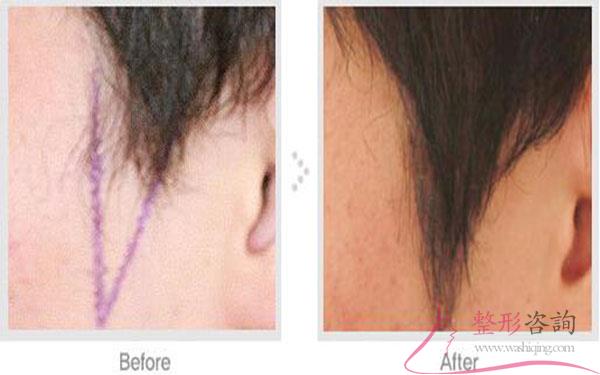 2013511485 2013511485