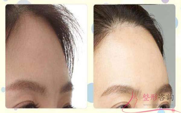 0913385933 0913385933