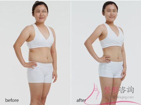 1141155927 1141155927