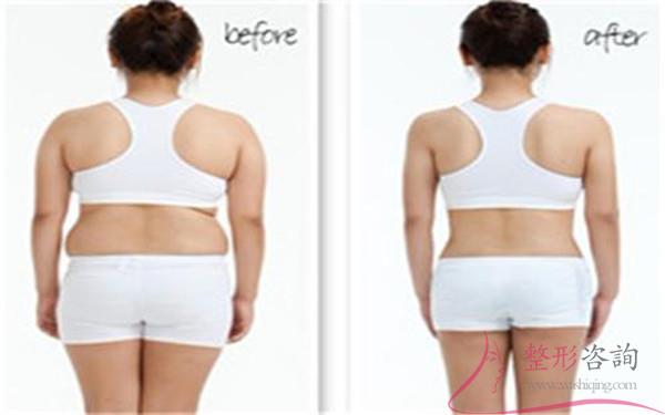 1153015881 1153015881