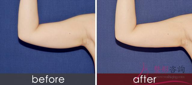 1334278247 1334278247