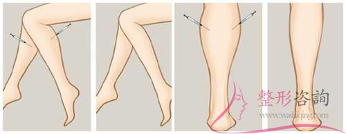 1427017863 1427017863