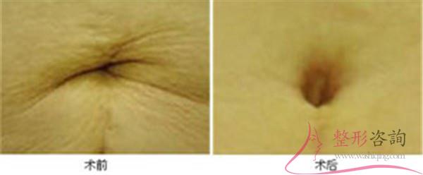 1443505427 1443505427