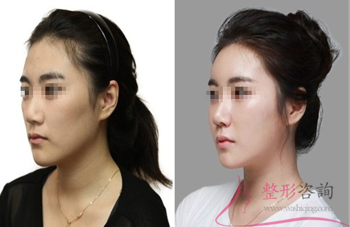 1551209598 1551209598