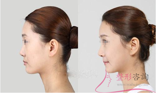 1551475136 1551475136