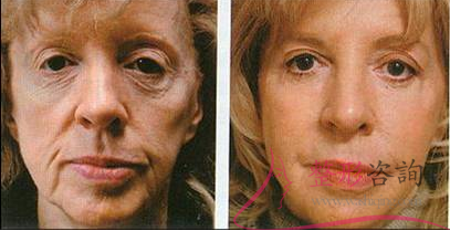 1552093333 1552093333