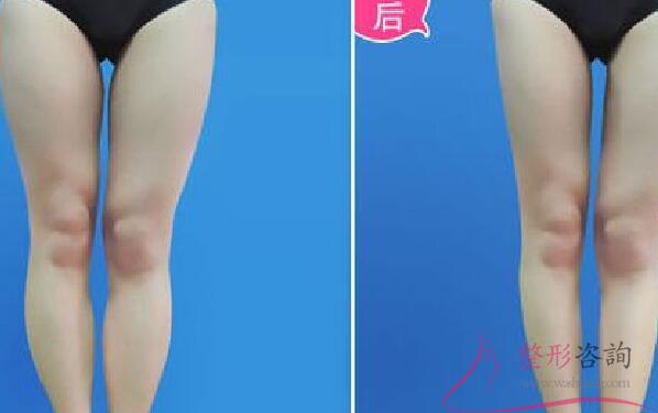 1553193040 1553193040