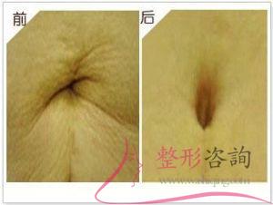 1651152732 1651152732