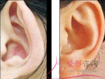 1102218212 1102218212