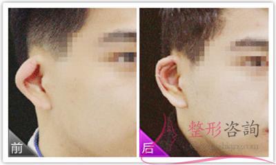 1118177940 1118177940