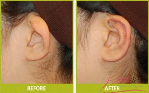 1531055700 1531055700