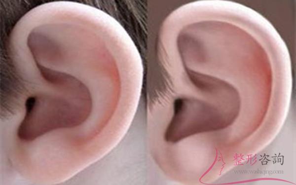 1635306886 1635306886